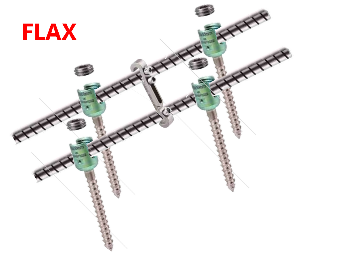 Транспедикулярна конструкція з гнучкими стрижнями FLAX (4 гвинта) Medical Concept